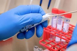راه حل‌های کرونا از نگاه جامعه جهانی