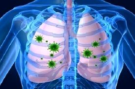 چرایی شدت درگیری ریه در افراد مختلف با کرونا مشخص نیست