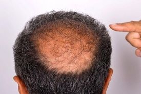 تاسی به عوارض کرونا اضافه شد!