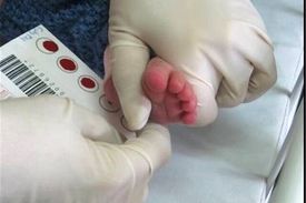 جزئیات غربالگری کم‌کاری تیروئید در نوزادان
