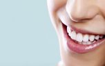 ۷ راهکار برای داشتن دندان های سفید و درخشان